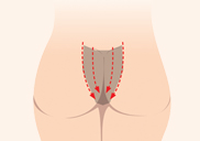 �ʰ��� �ǰ���
�κ� �ݽ����ǰ� ��������
���ູ���� ������