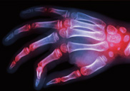 ����Ƽ�������� VS ���༺������
��� �ٸ���?