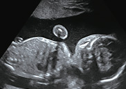 �ڿ��и�,
������ �鿪�¡� ���̴� �� ����ȴ�