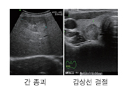 ������ ����, ��� �ٸ���?