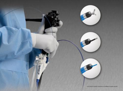보스턴사이언티픽의 췌담도 카테터 SpyGlass DS