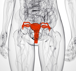 체중을 줄이면 자궁내막암 발병 위험이 줄일 수 있다는 연구결과가 나왔다.<사진:메디포토=포토애플>