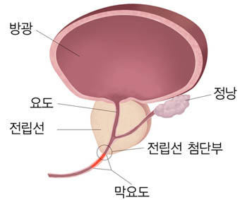 전립선과 요도 (이미지 제공 : 분당서울대병원)