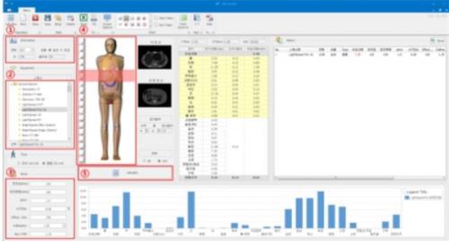 ALARA-CT 프로그램 화면.