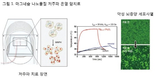 ▲마그네슘 나노물질 발열로 인한 시험관 내 악성뇌종양 세포 사멸 (그림=서울대병원 제공)