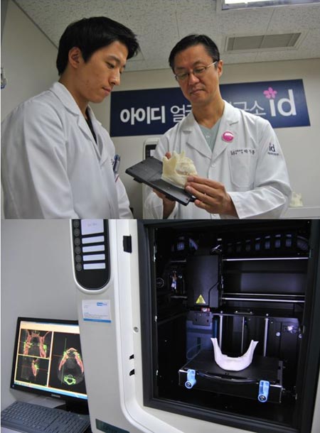 
	아이디성형외과병원 3D프린터 얼굴뼈 모형 제작
