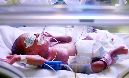 �̼��Ʒ� �¾ ���̰� ��ť������ �ȿ� �ִ�