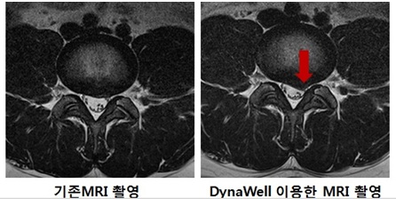  MRI Կ  ̳ ̿ MRI Կ   Ҵ