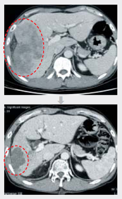 �� �����ʿ� 11�� ũ���� ���� �ִ� ����CT����(��)�� �������׾Ϲ�缱���ÿ���� �ϰ� �� �� �� ũ�Ⱑ 6.8���� �پ�� ���.