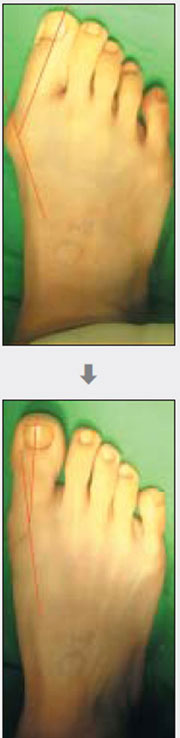 �����ܹ��� ���� ��(�� ����)���� �� ����