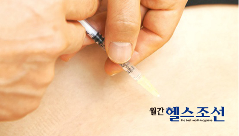 
	태반성분(펩타이드)으로 만든 주사제(약침)로 치료하는 장면. 피로가 쌓여 통증을 일으키는 관절·척추 통증이나 노화예방, 미용을 위해 태반을 활용한다.
