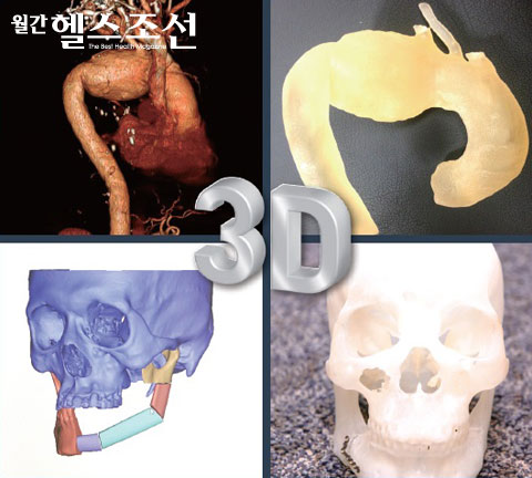 3 CT MRI  ü () 3D Ϳ Է  3D   Ȱ  ().  