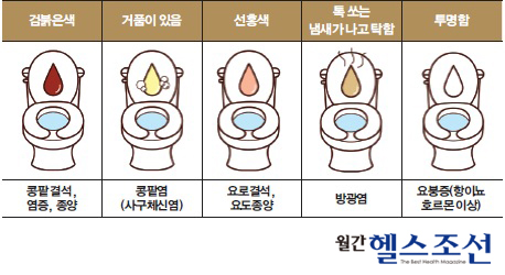 
	소변의 색과 냄새
