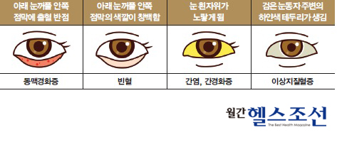 
	눈의 색깔
