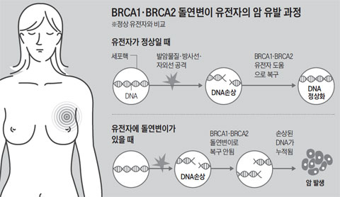 BRCA1BRCA2     .