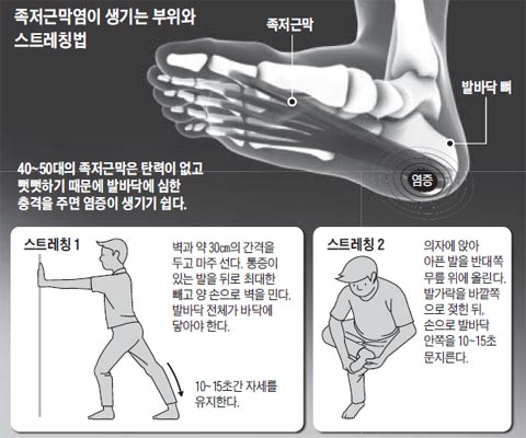 
	족저근막염 설명 그래픽
