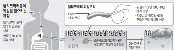 헬리코박터균이 위암을 일으키는 과정