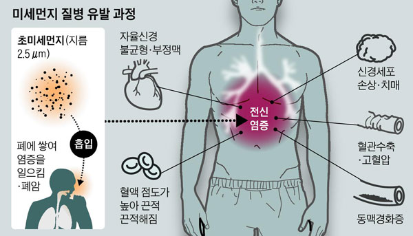 [그래픽] 미세먼지 질병 유발 과정