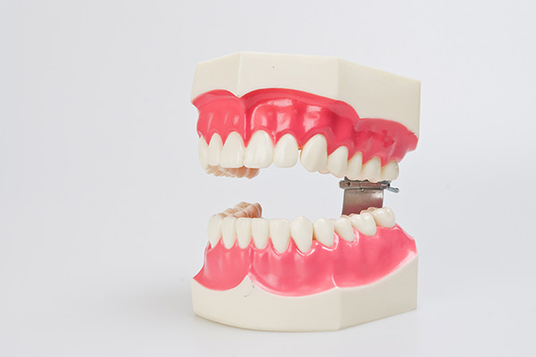 치아 모형