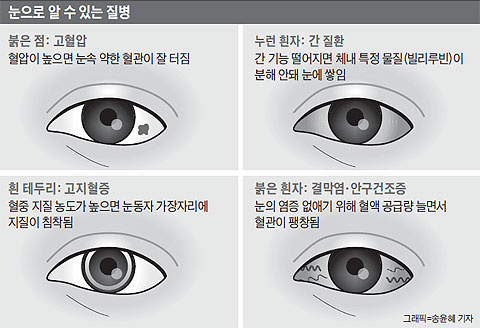 눈 색깔 관련 설명 그래픽
