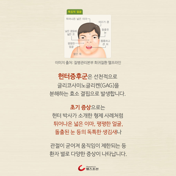 �������ı� ȯ�� �̹���