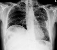 ���� ���� ȯ�� ���Ҽ�����, ���θ� ������ 80%�� ��ħ ���� ����..