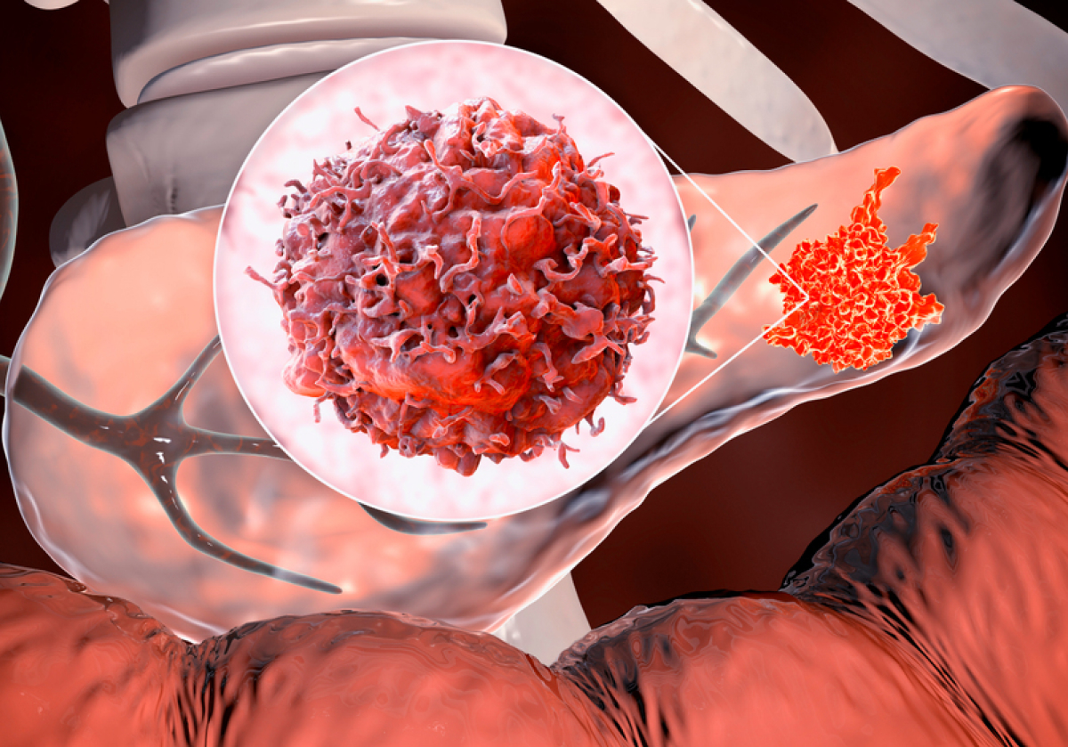 ��ǥ �̹���