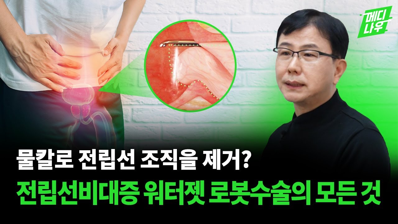 전립선비대증도 로봇 수술? 물의 칼날로 조직 제거, 아쿠아블레이션의 모든 것