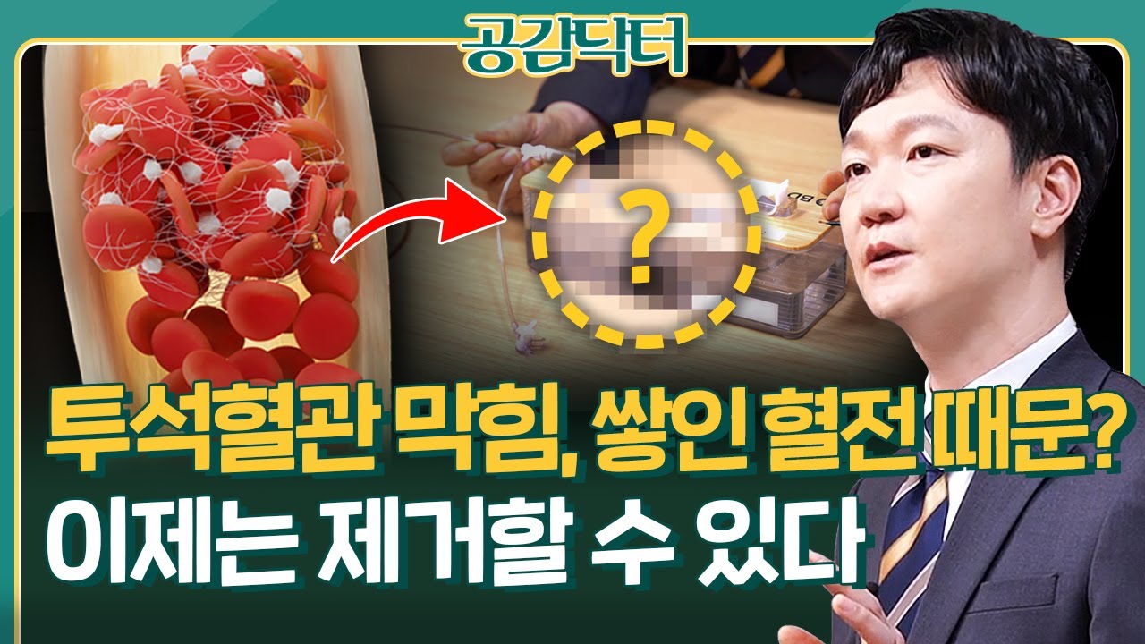 투석혈관 막힘, '쌓인 혈전' 이제는 제거할 수 있습니다