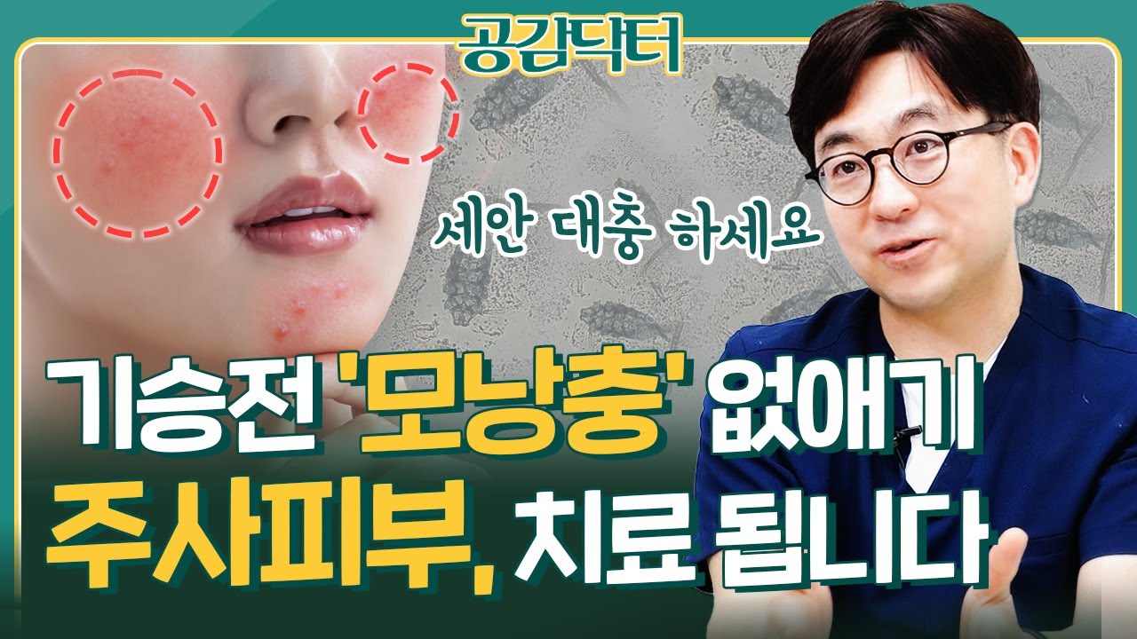 홍조? 여드름? 주사피부 치료는 모낭충 제거하면 됩니다