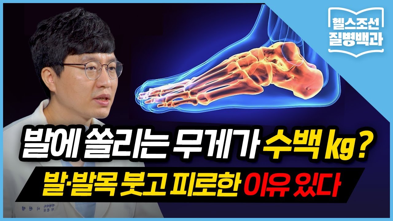 [발 건강] '제2의 심장' 발 망가지면… 전신 건강도 차례로 무너집니다