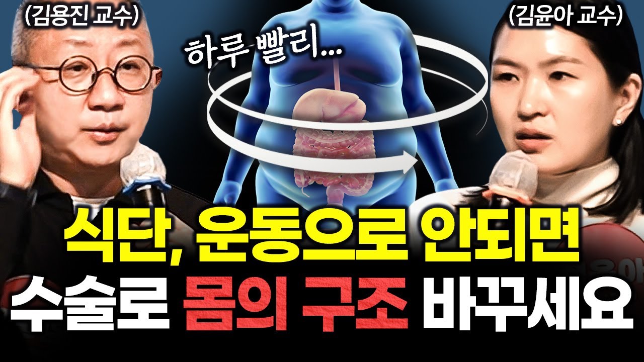 몸의 구조가 바뀝니다, 고도비만이라면? 비만대사수술 효과 알려드립니다!