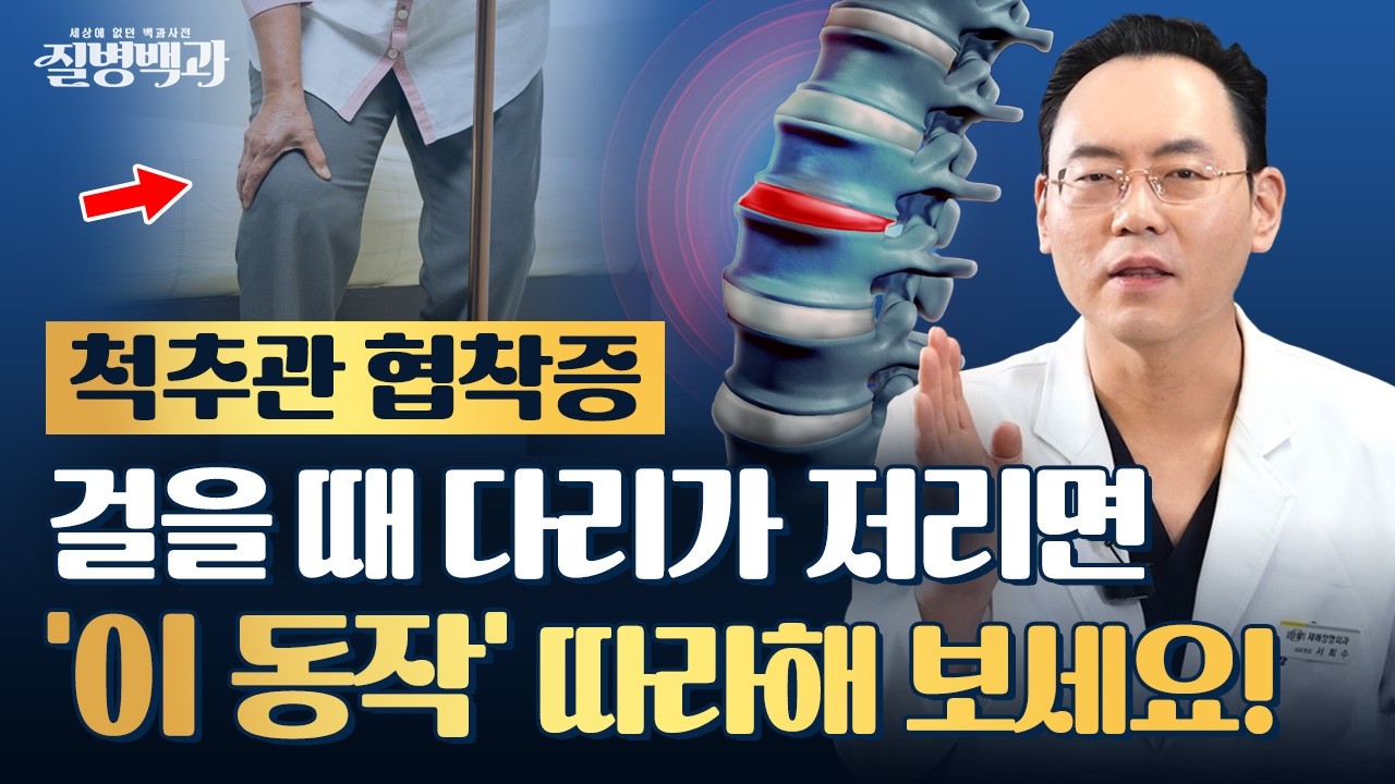 척추관 협착증, 걸을 때마다 다리가 저리다면? '이 동작' 따라 해 보세요!