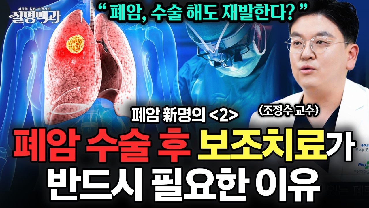 수술 후에도 재발? 폐암 수술 치료 역할과 그 이후 치료 전략