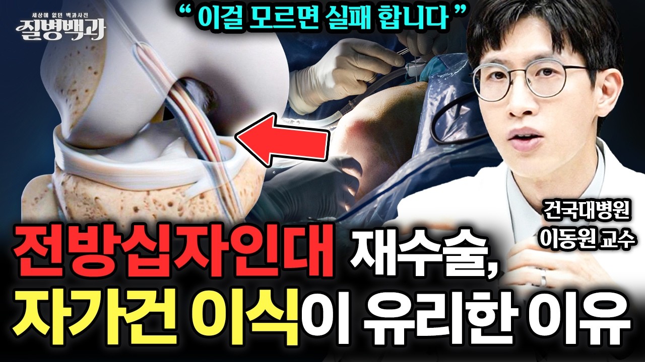 '이걸' 모르면 수술 실패 합니다! 전방십자인대 재수술, 자가건 이식이 유리한 이유는?