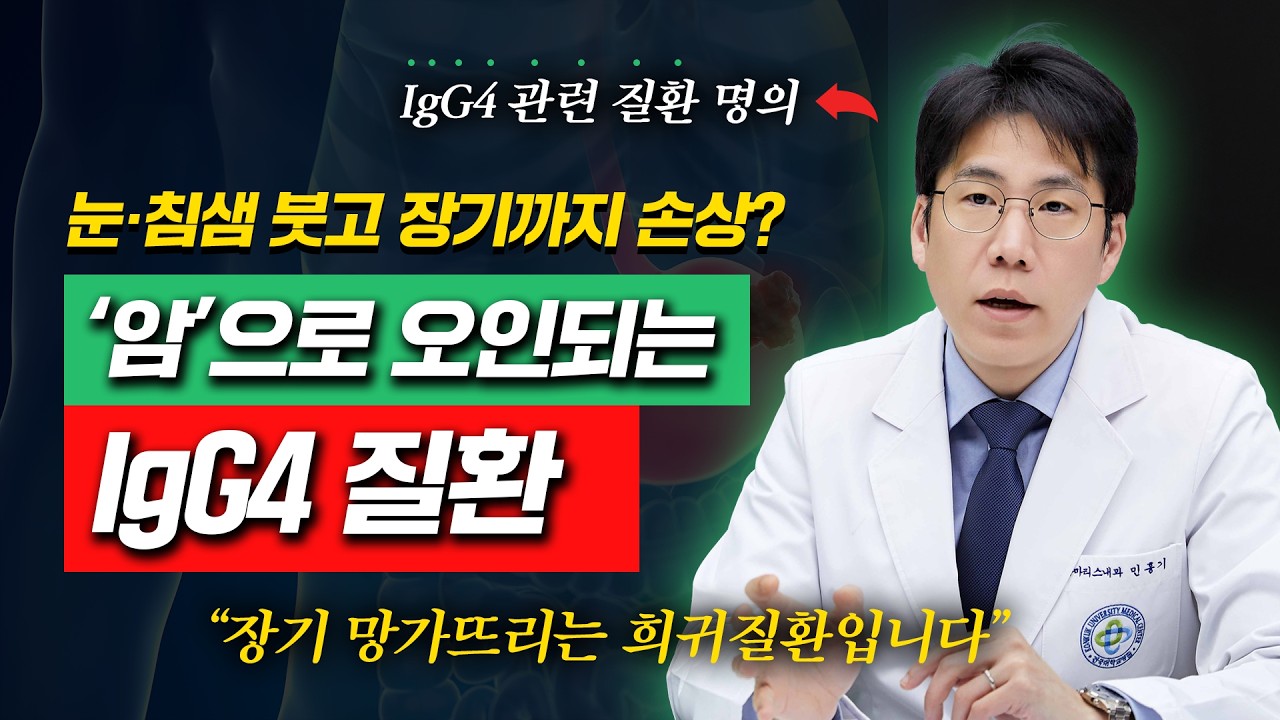 건강검진서 ‘덩어리’ 발견… 암 아닌 ‘IgG4 질환’일 수도 있습니다