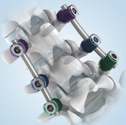 �����޵����� ��ǥ ��ǰ ANAX 5.5