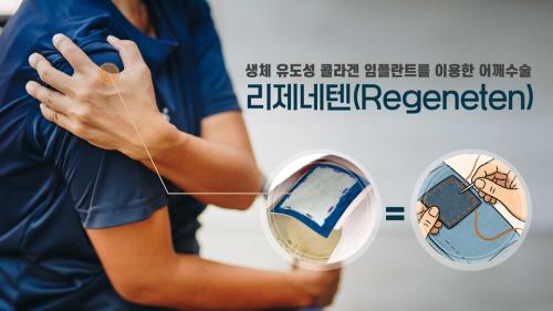 �̹�������=��������