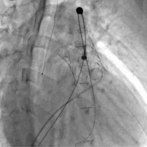 ������ �󵿸��Ǹ� ġȯ��(PPVI) �ü� ���(��������=����뺴��)