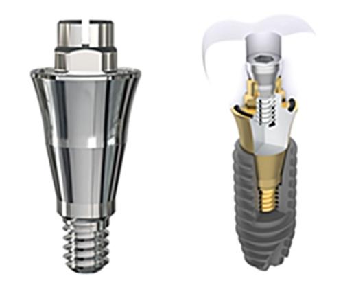 �����޵����� ġ�� ���ö�Ʈ ��ö ����ǰ '��絧Ʈ SA'