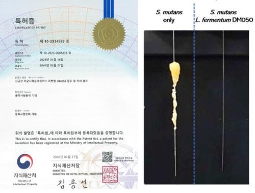 ������ ������ ��ġ ���α� S. mutans �ܵ� ��� �� ������ �ö��(��)�� ���� ����� L. fermentum DM050 ó�� �� �ö�� ������  ������ ���(��).