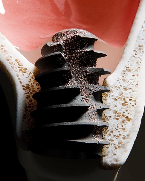 ������ö�Ʈ�� ������ ���̽��� ����ȭ�� ���ο� ���ö�Ʈ �ַ�� 'SICON'�� �����δ�.