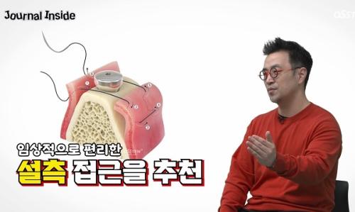 OSSTEM TV �����λ��̵� 38�� 5�� ����ö ������