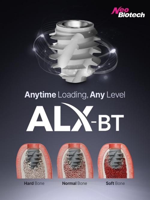 �׿����̿����� �����̴� ��� �ε� ���ö�Ʈ 'ALX-BT'�� ALX�� Internal Type���� ��� �ε��� Ưȭ�� ���踦 ������ �ʱ� �������� ũ�� ����ߴ�.