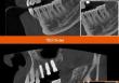 ���������ö�Ʈ�� ġ���� CBCT 'T2 Plus'�� ���� ����Ʈ����(SW) ���׷��̵带 ������ AI ��� ����ó�� ����� ����� �Կ� ���μ����� ���� ����Ʈ���� ������ ����ȭ�� ���� �ϼ����� ���� ȿ������ ������.