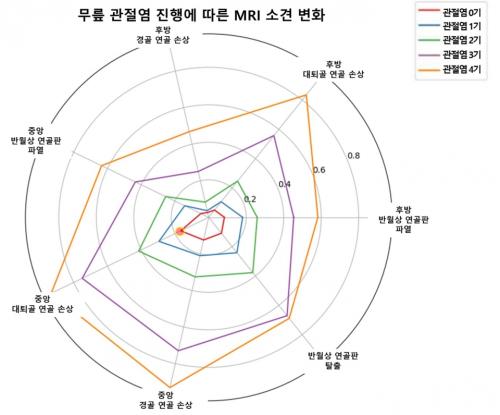 ���� ������ ���࿡ ���� MRI �Ұ�
