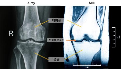 �������� �� MRI ���� ����(��ó: ��Ƽ�̹�����ũ, ����: ����뺴��)
