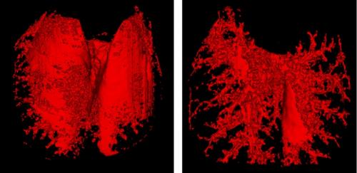 [�̼�CT ��� ���� ������ �м�]<br> TIF1�� ���� �� ����ȭ ����(������)�� �����ߴ�. [����=����뺴��]<br>