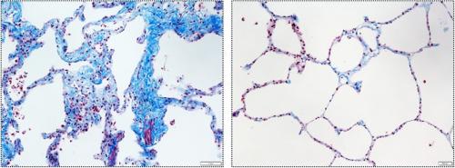 [ü�ܹ�� �ΰ� �� ���� �м�]<br> TIF1�� ���� �� ����ȭ�� ���� �ݶ�� ħ��(�Ķ���)�� ���ҵǰ� ������ ������ �����ƴ�.&nbsp;[����=����뺴��]<br>