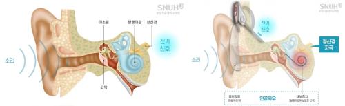 (ʺ) Ҹ  ޵Ǵ , ΰͿ Ҹ   [=д缭뺴 ]